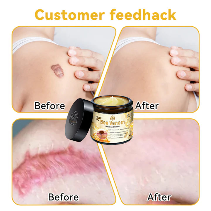 Bee Venom Skin Repair Cream