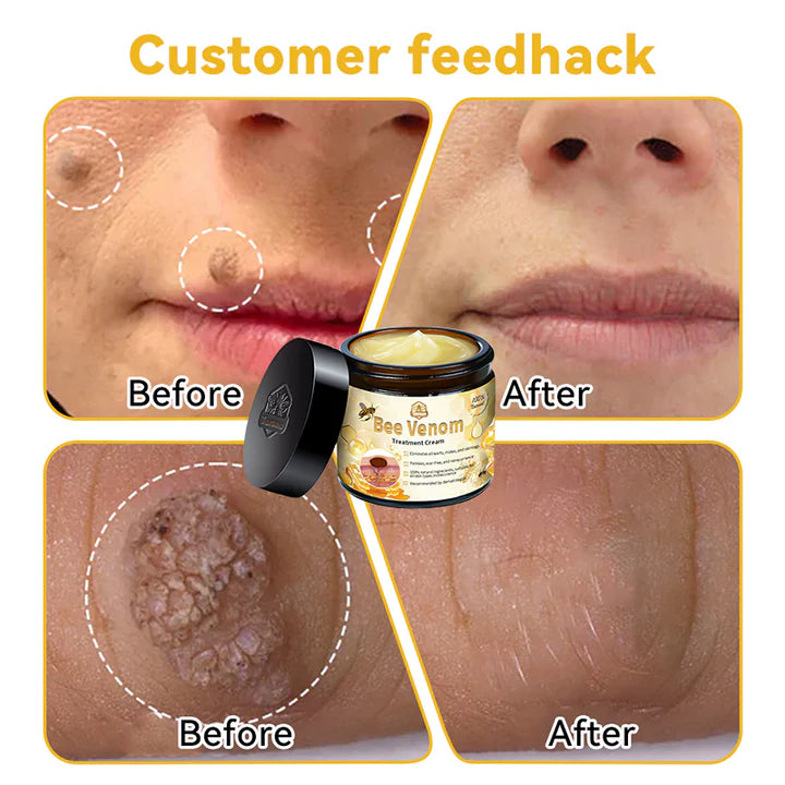 Bee Venom Skin Repair Cream